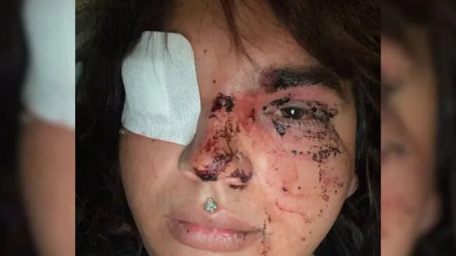 Una mujer transexual sufre una paliza a manos de un grupo de personas en La Bañeza (León)