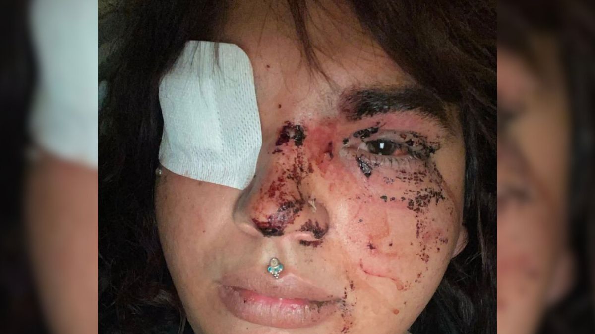 Detenidas cinco mujeres por la paliza a Miss Trans Zamora en La Bañeza (León)