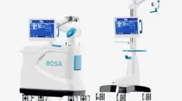 La Fundación Jiménez Díaz dispone de un robot para cirugía traumatológica de rodilla y cadera