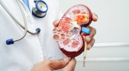 Los hospitales Quirónsalud del Sermas en 2025 detectaron 424 casos de enfermedad renal
