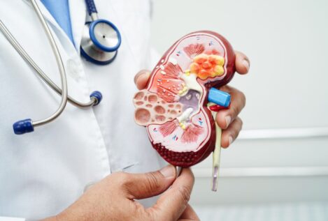 Los hospitales Quirónsalud del Sermas en 2025 detectaron 424 casos de enfermedad renal