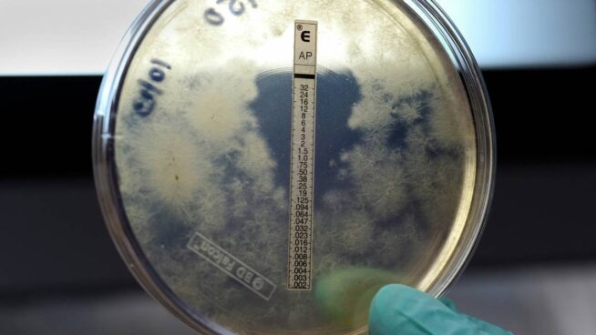 Meningitis B: qué se sabe tras el brote en Reino Unido y la situación en España