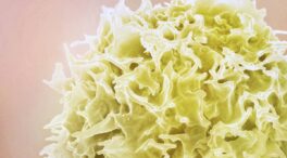 La obesidad deja una huella en las células incluso diez años después de perder peso