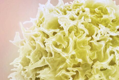 La obesidad deja una huella en las células incluso diez años después de perder peso