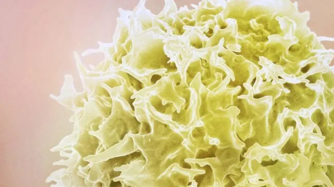 La obesidad deja una huella en las células incluso diez años después de perder peso