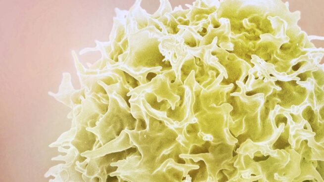 La obesidad deja una huella en las células incluso diez años después de perder peso