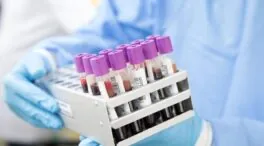 Primer caso de 'curación' del VIH con un trasplante de células madre de un hermano