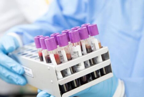 Primer caso de 'curación' del VIH con un trasplante de células madre de un hermano