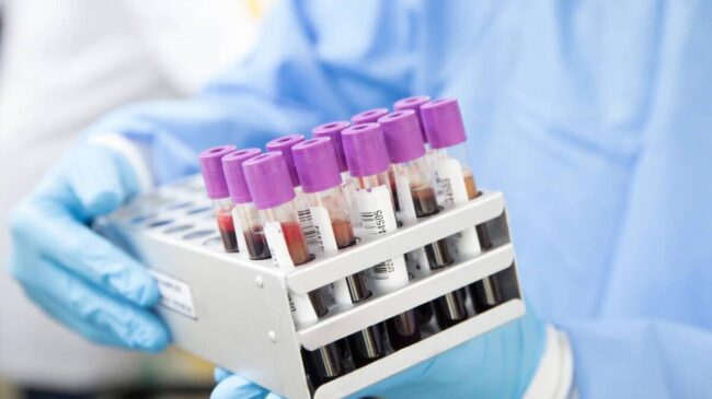 Primer caso de 'curación' del VIH con un trasplante de células madre de un hermano