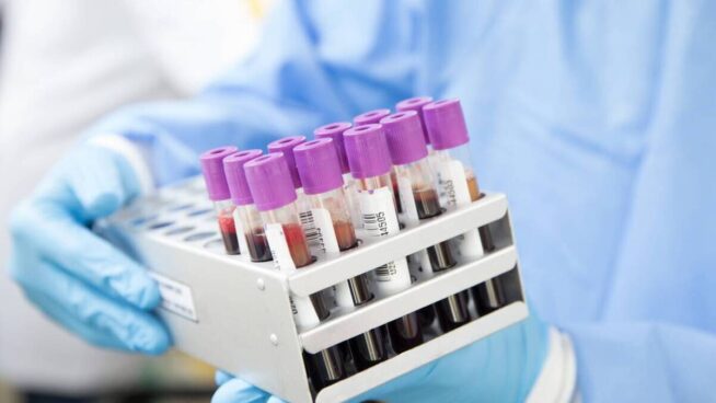 Primer caso de 'curación' del VIH con un trasplante de células madre de un hermano