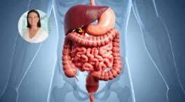 María Dolores de la Puerta, médico: «Las patas de las que se alimenta una buena microbiota son tres: la fibra, los alimentos fermentados y los polifenoles»